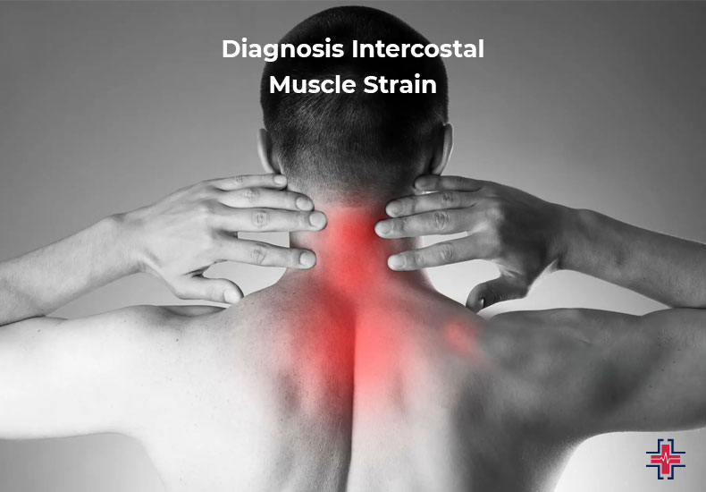 intercostal muscle strain